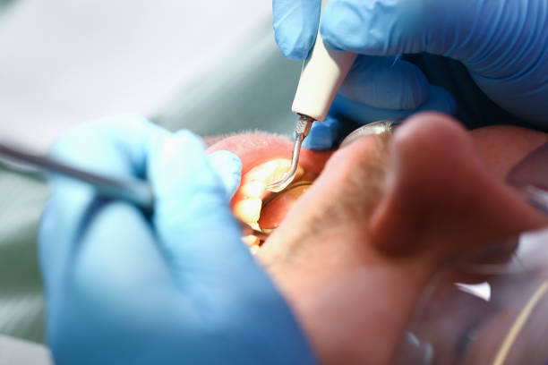 Best Tooth Infection Emergency Dentist  in Sonora, TX